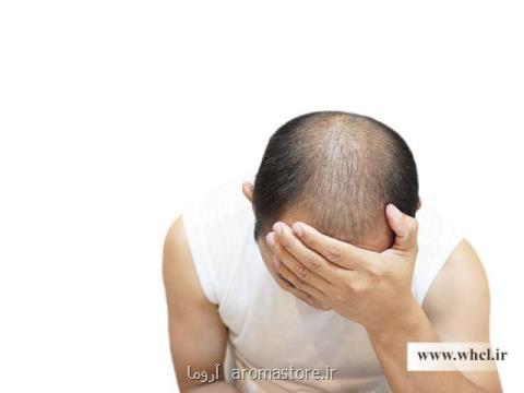 چند توصیه مهم بعد از كاشت مو