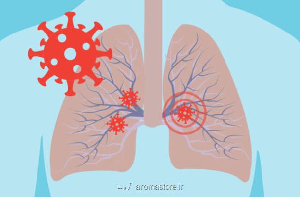 تایید ارتباط نارسایی تنفسی ناشی از كرونا با گروه خونی