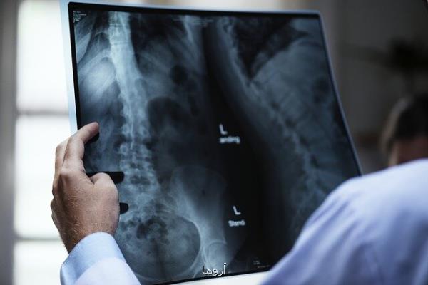 ضرورت اصلاح تعرفه های رادیولوژی در كشور